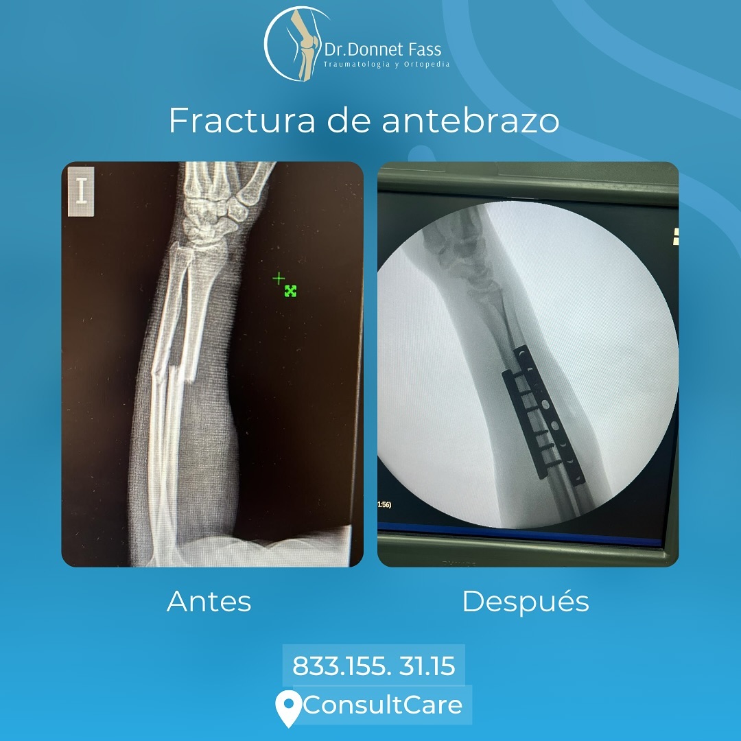 434432083_1492807961655323_899208815669292684_n